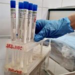 В Ульяновской области делается меньше всего тестов на COVID в ПФО